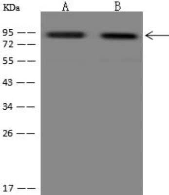 Western Blot: Ccd1/DIXDC1 Antibody [NBP3-12691] - Lane A: HeLa Whole Cell LysateLane B: Jurkat Whole Cell LysateLysates/proteins at 30 ug per lane.SecondaryGoat Anti-Rabbit IgG (H+L)/HRP at 1/10000 dilution.Developed using the ECL technique.Performed under reducing conditions.Predicted band size:77 kDa