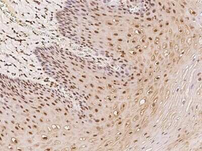 Immunohistochemistry-Paraffin: Cdc14B Antibody [NBP2-98128] - Staining of human Cdc14B in human esophagus with rabbit polyclonal antibody at 1:500 dilution.