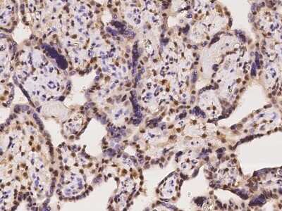 Immunohistochemistry-Paraffin: Cdc14B Antibody [NBP2-98128] - Staining of human Cdc14B in human placenta with rabbit polyclonal antibody at 1:500 dilution. 