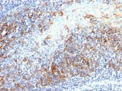 Immunohistochemistry-Paraffin: Cdc20 Antibody (AR12) - Azide and BSA Free [NBP2-34552] - Formalin-fixed, paraffin-embedded human Tonsil stained with Cdc20 Antibody (AR12).