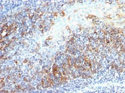 Immunohistochemistry-Paraffin: Cdc20 Antibody (AR12) - IHC-Prediluted [NBP2-44406] - Formalin-fixed, paraffin-embedded human Tonsil stained with Cdc20 Antibody (AR12).