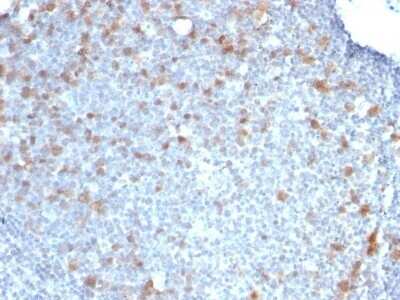 Immunohistochemistry-Paraffin: Cdc20 Antibody (CDC20/1102) - Azide and BSA Free [NBP2-47811] - Human Tonsil stained with CDC20 Monoclonal Antibody (CDC20/1102)