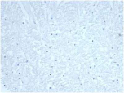 Immunohistochemistry-Paraffin: Cdc20 Antibody (CDC20/7026R) [NBP3-13820] - IHC analysis of formalin-fixed, paraffin-embedded human brain. Negative tissue control using Cdc20 antibody (CDC20/7026R)at 2ug/ml in PBS for 30min RT. HIER: Tris/EDTA, pH9.0, 45min. HRP-polymer, 30min. DAB, 5min.