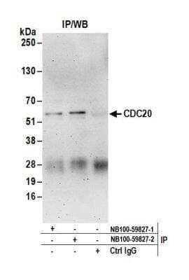 Immunoprecipitation: Cdc20 Antibody [NB100-59827] - Detection of human CDC20 by western blot of immunoprecipitates. Samples: Whole cell lysate (1 mg for IP; 20% of IP loaded) from HeLa cells. Antibodies: Affinity purified rabbit anti-CDC20 antibody NB100-59827 (lot 2) used for IP at 6 ug/mg lysate. CDC20 was also immunoprecipitated by a previous lot (lot 1) of this antibody. For blotting immunoprecipitated CDC20, NB100-59827 was used at 1 ug/ml. Detection: Chemiluminescence with an exposure time of 3 minutes.