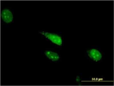 Immunocytochemistry/Immunofluorescence: Cdc23 Antibody (1F3) [H00008697-M08] - Analysis of monoclonal antibody to CDC23 on HeLa cell. Antibody concentration 10 ug/ml