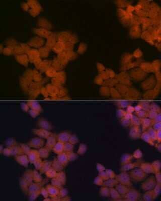 Immunocytochemistry/Immunofluorescence: Cdc23 Antibody (1Q2I3) [NBP3-16631] - Immunofluorescence analysis of HeLa cells using Cdc23 Rabbit mAb (NBP3-16631) at dilution of 1:100 (40x lens). Blue: DAPI for nuclear staining.