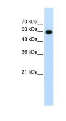 Western Blot: Cdc23 Antibody [NBP1-55022] - Jurkat cell lysate, concentration 1.25ug/ml.