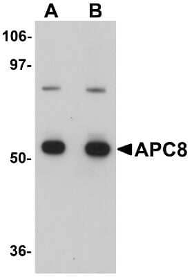 Western Blot: Cdc23 Antibody [NBP1-77156] - K562 cell lysate with Cdc23 antibody at (A) 1 and (B) 2 ug/mL.