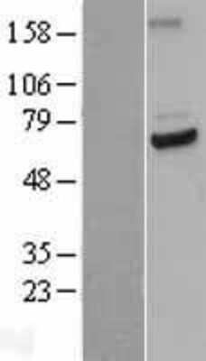 Western Blot: Cdc23 Overexpression Lysate (Adult Normal) [NBL1-08993] Left-Empty vector transfected control cell lysate (HEK293 cell lysate); Right -Over-expression Lysate for Cdc23.