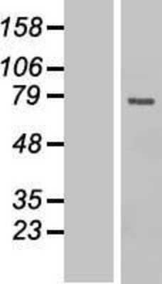 Western Blot: Cdc25B Overexpression Lysate (Adult Normal) [NBP2-06512] Left-Empty vector transfected control cell lysate (HEK293 cell lysate); Right -Over-expression Lysate for Cdc25B.