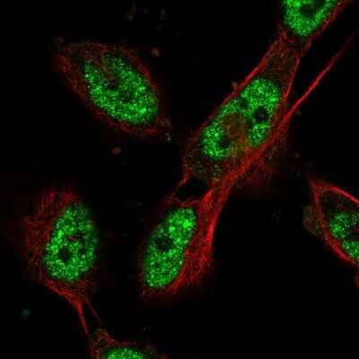 Immunocytochemistry/Immunofluorescence: Cdc27 Antibody [NBP2-56172] - Staining of human cell line U-251 MG shows localization to nucleoplasm.