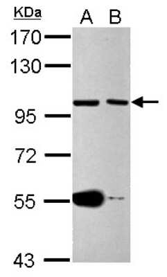 Western Blot: Cdc27 Antibody [NBP2-15829] - Sample (30 ug of whole cell lysate) A: Jurkat B: Jurkat nucleus 7. 5% SDS PAGE gel, diluted at 1:1000.