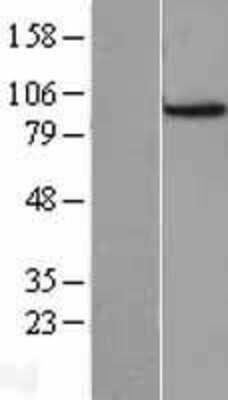 Western Blot: Cdc27 Overexpression Lysate (Adult Normal) [NBL1-08998] Left-Empty vector transfected control cell lysate (HEK293 cell lysate); Right -Over-expression Lysate for Cdc27.