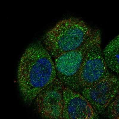 Immunocytochemistry/Immunofluorescence: Cdc6 Antibody [NBP2-68827] - Staining of human cell line HaCaT shows localization to nucleus, cytosol, cytokinetic bridge & mitotic spindle.