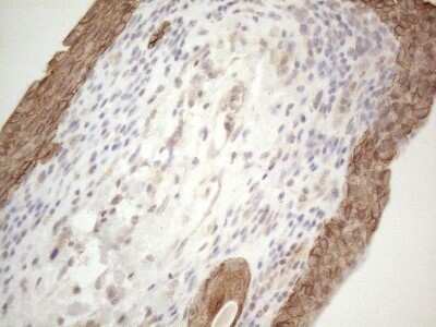 Immunohistochemistry: Cdc6 Antibody (OTI1A4) - Azide and BSA Free [NBP2-70383] - Analysis of Human bladder tissue. (Heat-induced epitope retrieval by 1mM EDTA in 10mM Tris buffer (pH8.5) at 120C for 3 min)