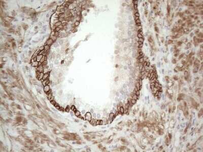 Immunohistochemistry: Cdc6 Antibody (OTI1A4) - Azide and BSA Free [NBP2-70383] - Analysis of Human prostate tissue. (Heat-induced epitope retrieval by 1mM EDTA in 10mM Tris buffer (pH8.5) at 120C for 3 min)