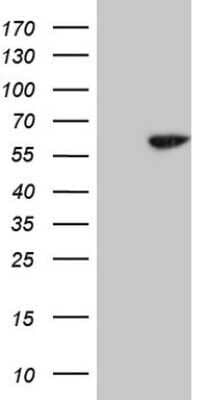 Western Blot: Cdc6 Antibody (OTI1A4) - Azide and BSA Free [NBP2-70383] - Analysis of HEK293T cells were transfected with the pCMV6-ENTRY control (Left lane) or pCMV6-ENTRY CDC6.