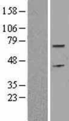 Western Blot: Cdc6 Overexpression Lysate (Adult Normal) [NBL1-09014] Left-Empty vector transfected control cell lysate (HEK293 cell lysate); Right -Over-expression Lysate for Cdc6.