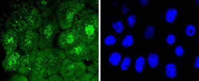 Immunocytochemistry/Immunofluorescence: Cdc6 [p Ser54] Antibody (SD08-47) [NBP2-67830] - Staining Phospho-Cdc6(S54) in A431 cells (green). The nuclear counter stain is DAPI (blue). Cells were fixed in paraformaldehyde, permeabilised with 0.25% Triton X100/PBS.