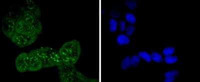 Immunocytochemistry/Immunofluorescence: Cdc6 [p Ser54] Antibody (SD08-47) [NBP2-67830] - Staining Phospho-Cdc6(S54) in Hela cells (green). The nuclear counter stain is DAPI (blue). Cells were fixed in paraformaldehyde, permeabilised with 0.25% Triton X100/PBS.