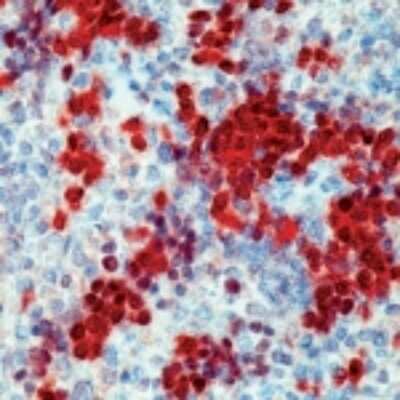 Immunohistochemistry-Paraffin: Cdk2 Antibody (2B6) [NBP2-26448] - IHC analysis of Cdk2 formalin-fixed paraffin embedded human spleen using NBP2-26448.