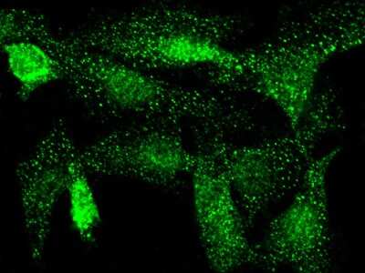Immunocytochemistry/Immunofluorescence: Cdk3 Antibody [NBP2-98989] - Immunofluorescence staining of Cdk3 in U251MG cells. Cells were fixed with 4% PFA, permeabilzed with 0.3% Triton X-100 in PBS, blocked with 10% serum, and incubated with rabbit anti-Human Cdk3 polyclonal antibody (dilution ratio 1:1000) at 4C overnight. Then cells were stained with the Alexa Fluor$488-conjugated Goat Anti-rabbit IgG secondary antibody (green). Positive staining was localized to cytoplasm and nucleus.