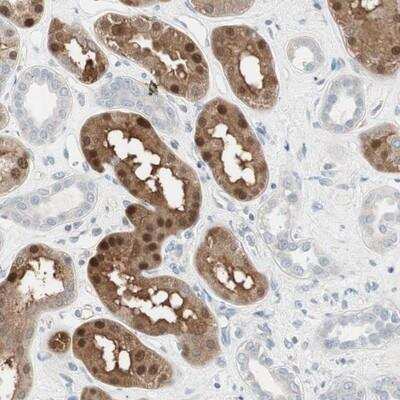 Immunohistochemistry-Paraffin: Cdk3 Antibody [NBP1-86496] - Staining of human kidney shows strong nuclear and cytoplasmic positivity in cells in tubules.
