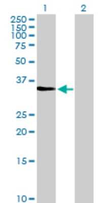 Western Blot: Cdk3 Antibody [H00001018-D01P] - Analysis of CDK3 expression in transfected 293T cell line by CDK3 polyclonal antibody.Lane 1: CDK3 transfected lysate(35.00 KDa).Lane 2: Non-transfected lysate.