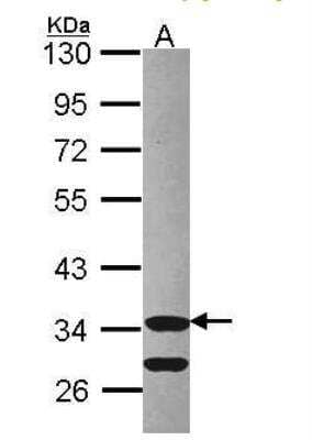 Western Blot: Cdk3 Antibody [NBP1-32230] - Sample (30 ug of whole cell lysate) A: Hep G2 10% SDS PAGE Cdk3 antibody  diluted at 1:1000 