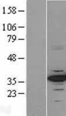 Western Blot CDK4 Overexpression Lysate