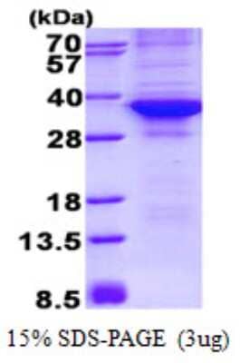 SDS-Page: Recombinant Human CDK4 Protein [NBP2-22974]