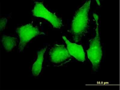 Immunocytochemistry/Immunofluorescence: Cdk5 Antibody [H00001020-B02P] - Analysis of purified antibody to CDK5 on HeLa cell. (antibody concentration 10 ug/ml)