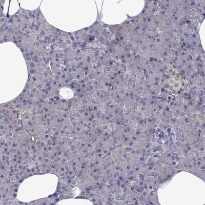 Immunohistochemistry-Paraffin: Cdk5 Antibody [NBP2-55870] - Staining of human pancreas shows low expression as expected.