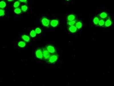 Immunocytochemistry/Immunofluorescence: Cdk5 Antibody (OTI2H6) - Azide and BSA Free [NBP2-70396] - Staining of HT29 cells using anti-Cdk5 mouse monoclonal antibody.