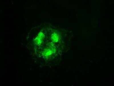 Immunocytochemistry/Immunofluorescence: Cdk5 Antibody (OTI2H6) - Azide and BSA Free [NBP2-70396] - Staining of COS7 cells transiently transfected by pCMV6-ENTRY Cdk5.