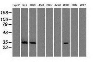 Western Blot: Cdk5 Antibody (OTI2H6) - Azide and BSA Free [NBP2-70396] - Analysis of extracts (35ug) from 9 different cell lines by using anti-Cdk5 monoclonal antibody.