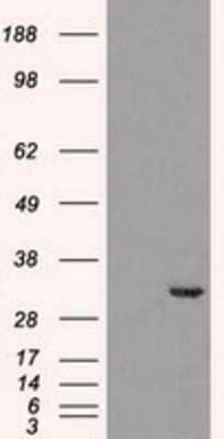 Western Blot: Cdk5 Antibody (OTI2H6) - Azide and BSA Free [NBP2-70396] - HEK293T cells were transfected with the pCMV6-ENTRY control (Left lane) or pCMV6-ENTRY Cdk5 (Right lane) cDNA for 48 hrs and lysed. Equivalent amounts of cell lysates (5 ug per lane) were separated by SDS-PAGE and immunoblotted with anti-Cdk5.