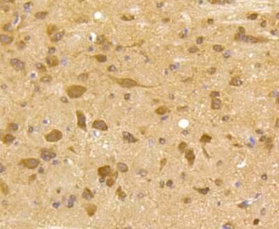Immunohistochemistry-Paraffin: Cdk5 Antibody (SR39-01) [NBP2-67319] - Analysis of paraffin-embedded mouse brain tissue using anti-Cdk5 antibody. Counter stained with hematoxylin.