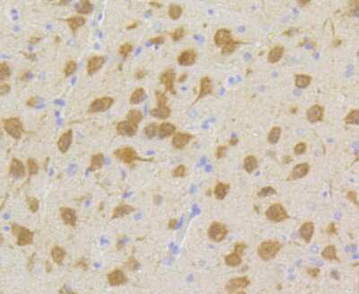 Immunohistochemistry-Paraffin: Cdk5 Antibody (SR39-01) [NBP2-67319] - Analysis of paraffin-embedded rat brain tissue using anti-Cdk5 antibody. Counter stained with hematoxylin.
