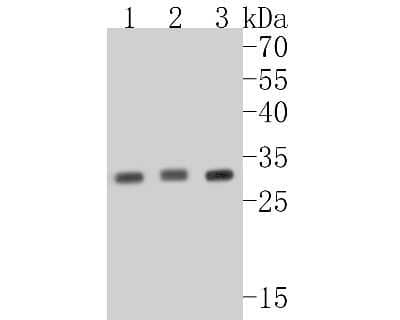 Western Blot: Cdk5 Antibody (SR39-01) [NBP2-67319] - Western blot analysis of Cdk5 on different lysates. Proteins were transferred to a PVDF membrane and blocked with 5% BSA in PBS for 1 hour at room temperature. The primary antibody (1/500) was used in 5% BSA at room temperature for 2 hours. Goat Anti-Rabb