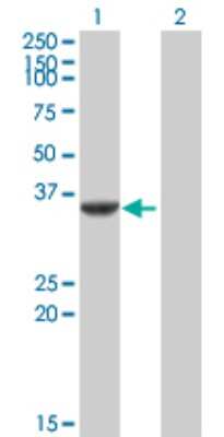 Western Blot: Cdk5 Antibody [H00001020-B02P] - Analysis of CDK5 expression in transfected 293T cell line by CDK5 polyclonal antibody.  Lane 1: CDK5 transfected lysate(32.12 KDa). Lane 2: Non-transfected lysate.