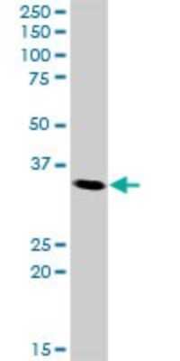Western Blot: Cdk5 Antibody [H00001020-D01P] - Analysis of CDK5 expression in HeLa.