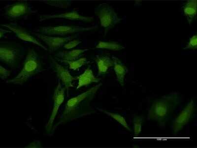 Immunocytochemistry/Immunofluorescence: Cdk6 Antibody [H00001021-B01P] - Analysis of purified antibody to CDK6 on HeLa cell. (antibody concentration 10 ug/ml)