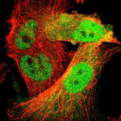 Immunocytochemistry/Immunofluorescence: Cdk6 Antibody [NBP1-87262] - Staining of human cell line U-251 MG shows localization to nucleoplasm and cytosol. Antibody staining is shown in green.