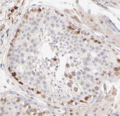 Immunohistochemistry-Paraffin: Cdk6 Antibody [NBP1-87262] - Staining of human testis shows moderate nuclear positivity in cells in seminiferous ducts.