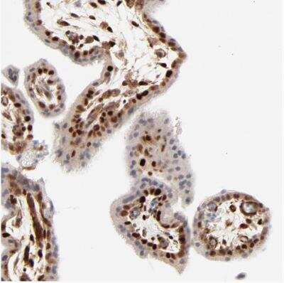 Immunohistochemistry-Paraffin: Cdk6 Antibody [NBP1-87262] - Staining of human placenta shows strong nuclear positivity in trophoblastic cells.