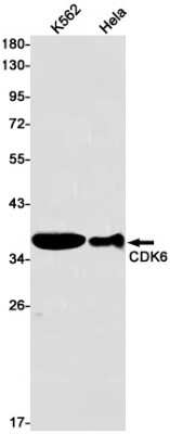 Western Blot: Cdk6 Antibody (S03-2G5) [NBP3-14918] - Western blot detection of CDK6 in K562, Hela cell lysates using CDK6 Rabbit mAb (1:1000 diluted). Predicted band size: 37kDa. Observed band size: 37kDa.