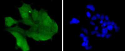 Immunocytochemistry/Immunofluorescence: Cdk6 Antibody (SD20-50) [NBP2-67758] - Staining Cdk6 in 293 cells (green). The nuclear counter stain is DAPI (blue). Cells were fixed in paraformaldehyde, permeabilised with 0.25% Triton X100/PBS.