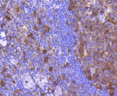 Immunohistochemistry-Paraffin: Cdk6 Antibody (SD20-50) [NBP2-67758] - Analysis of paraffin-embedded human tonsil tissue using anti-Cdk6 antibody. Counter stained with hematoxylin.
