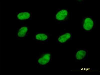 Immunocytochemistry/Immunofluorescence: Cdk7 Antibody [H00001022-B01P] - Analysis of purified antibody to CDK7 on HeLa cell. (antibody concentration 10 ug/ml)